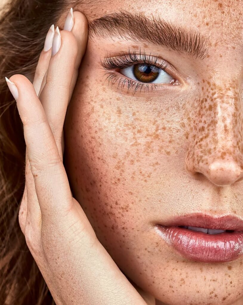 ipl photo rejuvenation in dubai