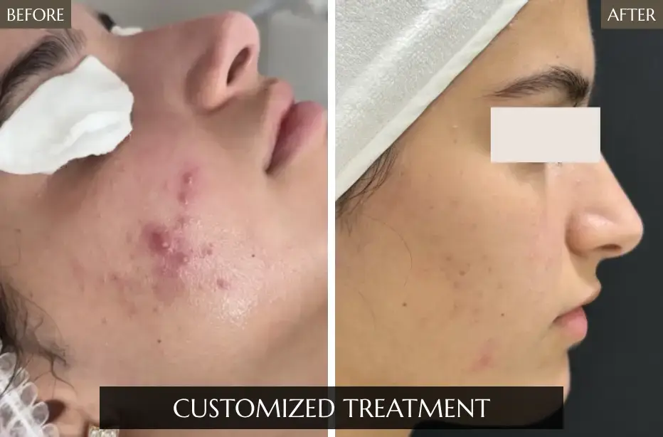 Customized-Treatment
