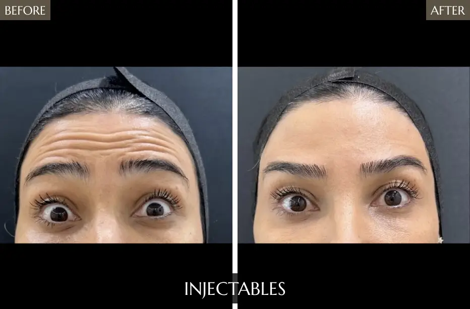 Injectables