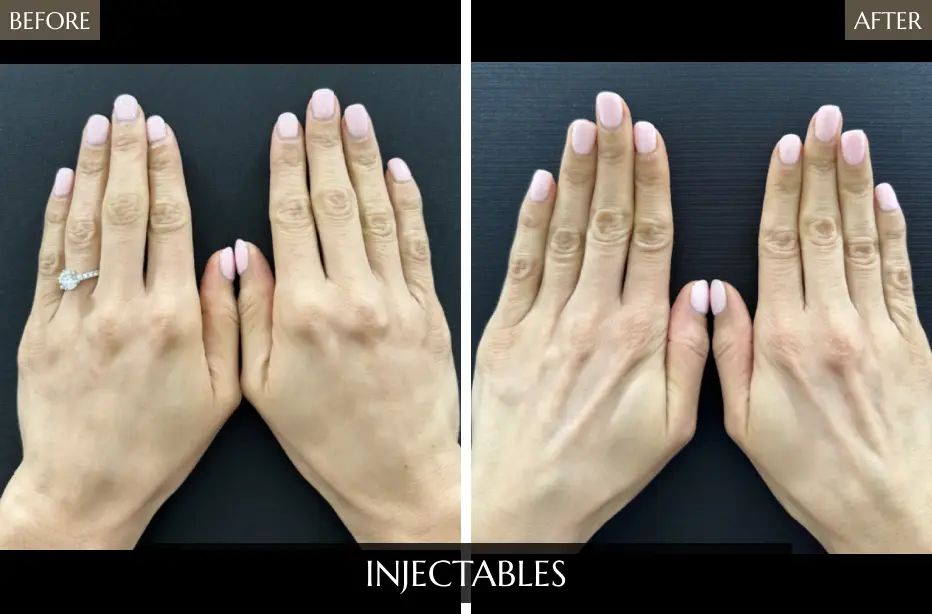 Injectables2