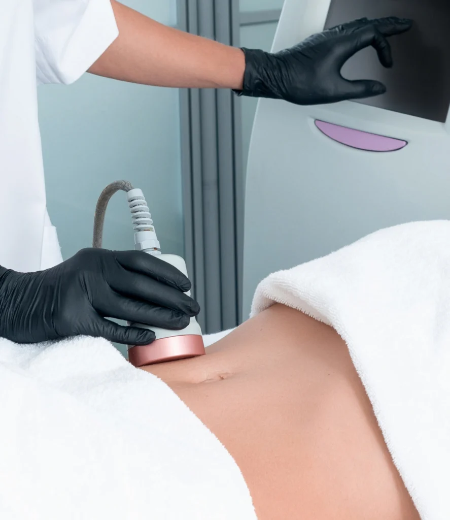 body contouring