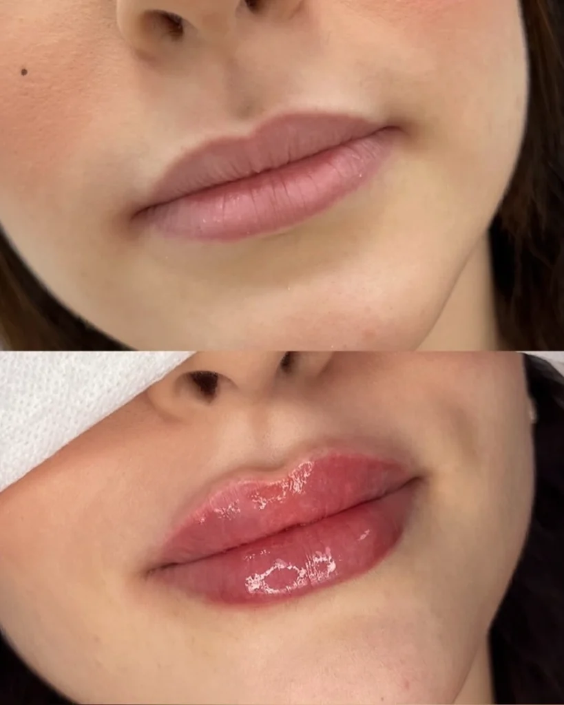 lip russian technique