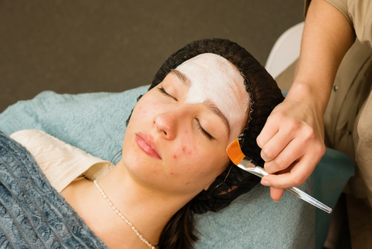 acne facial in dubai