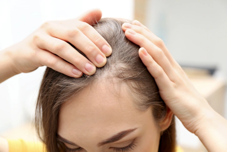 hair fall treatment in Dubai