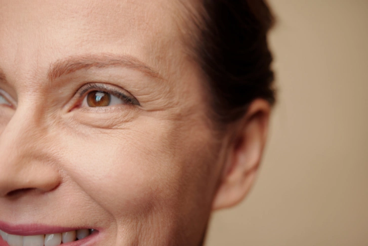 wrinkles