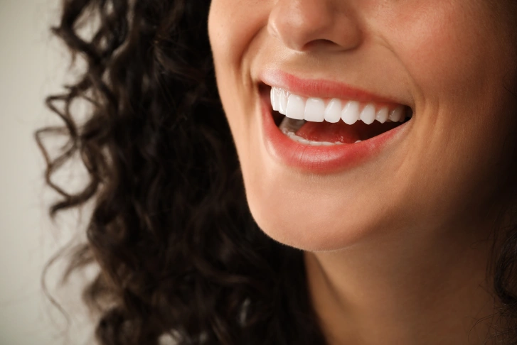veneers Dubai