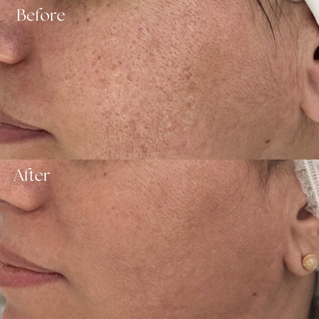 Combination treatments - 1