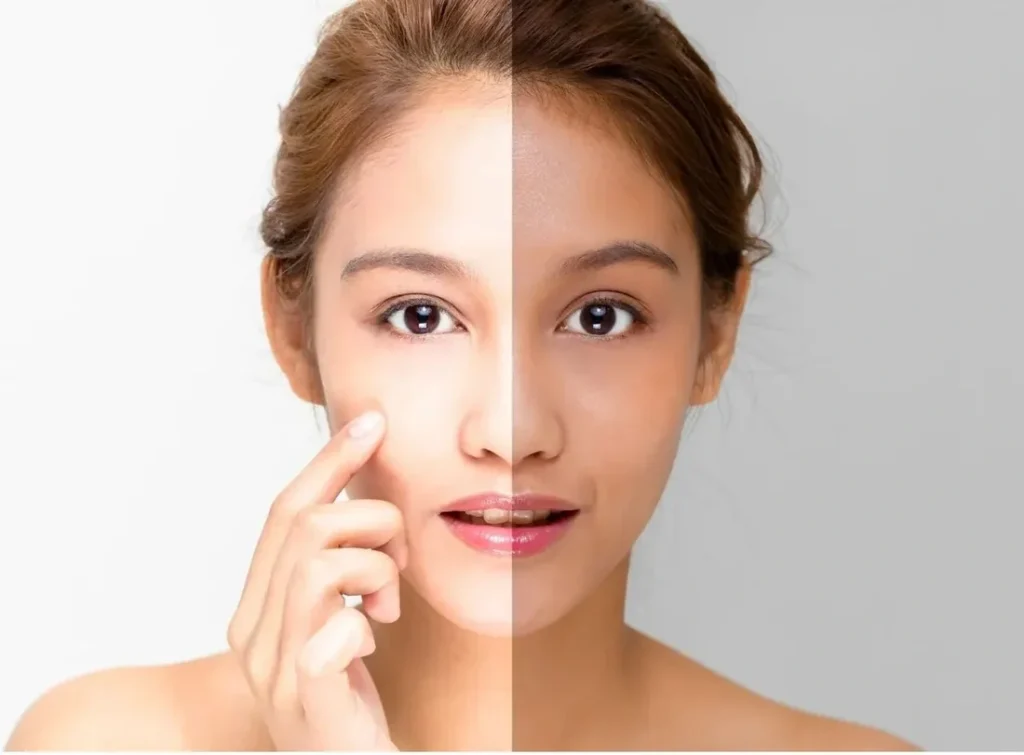 Skin Brightening: What Really Works