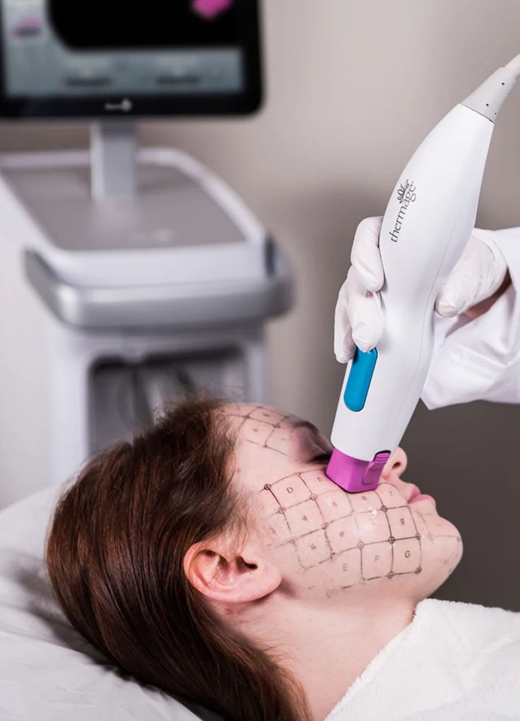 Thermage FLX in Dubai - Roxana Aesthetics Clinic