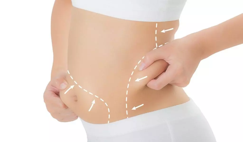 Understanding Non-Surgical Fat Reduction Treatments