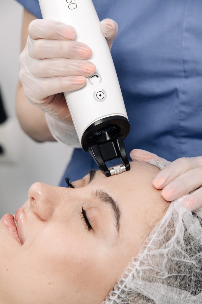 Frax Pro in Dubai - Roxana Aesthetics Clinic