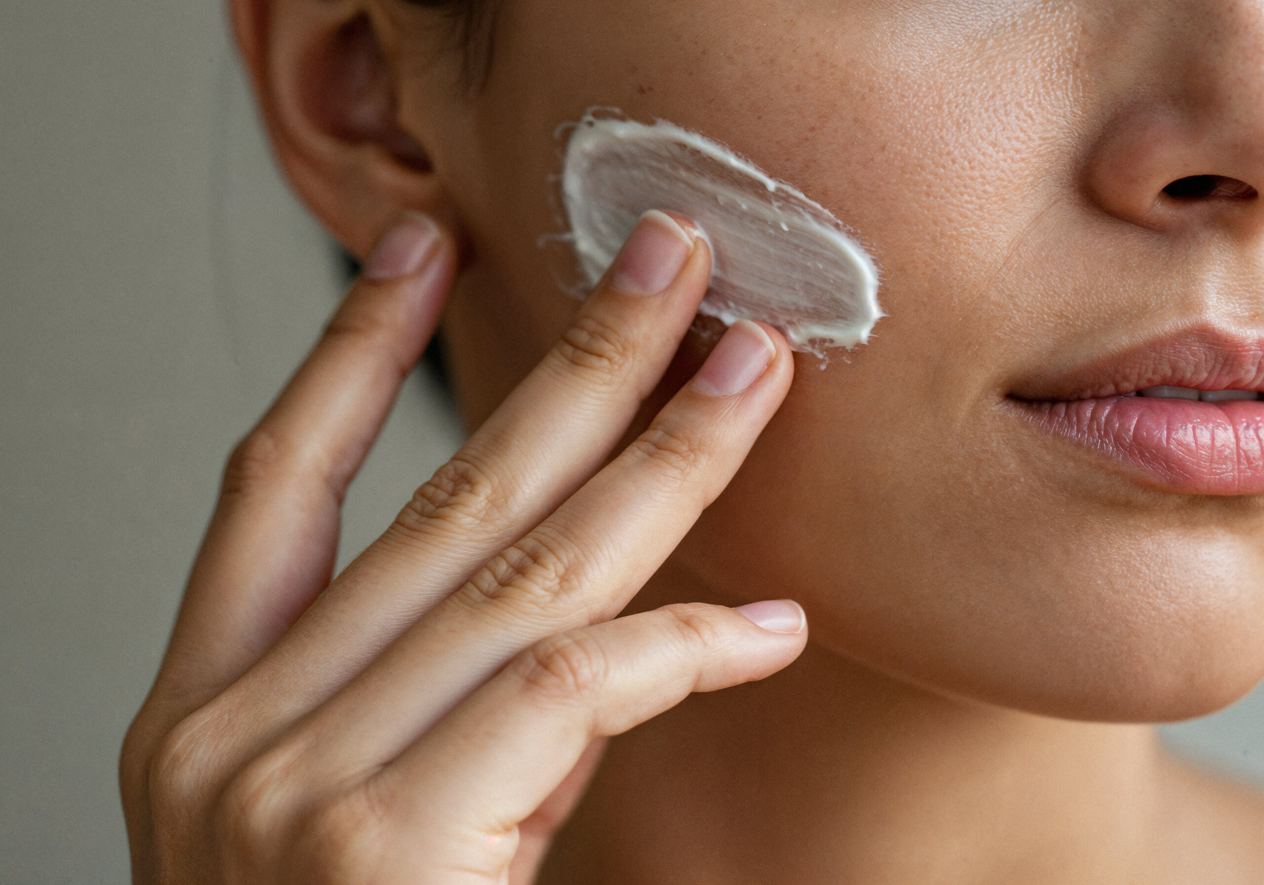 Woman Applying Face Cream Her Skin Scaled