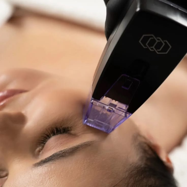 Morpheus8 treatment Dubai - Roxana Aesthetics Clinic