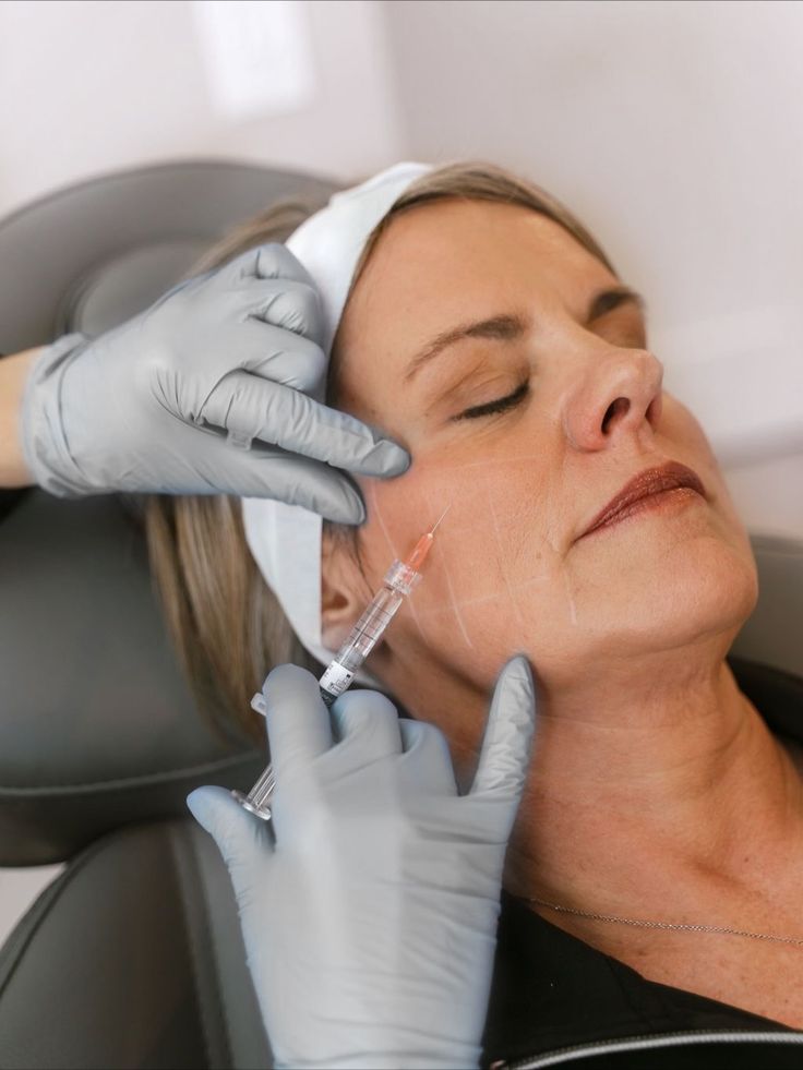 Sculptra Treatment Dubai - Roxana Aesthetics Clinic