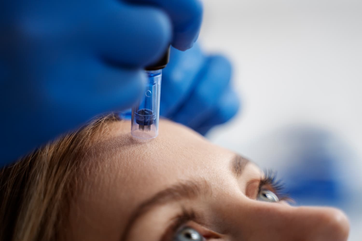 AnteAge MDX treatment - Roxana Aesthetics Clinic