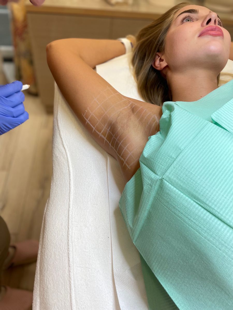 hyperhidrosis treatment dubai - Roxana Aesthetics Clinic