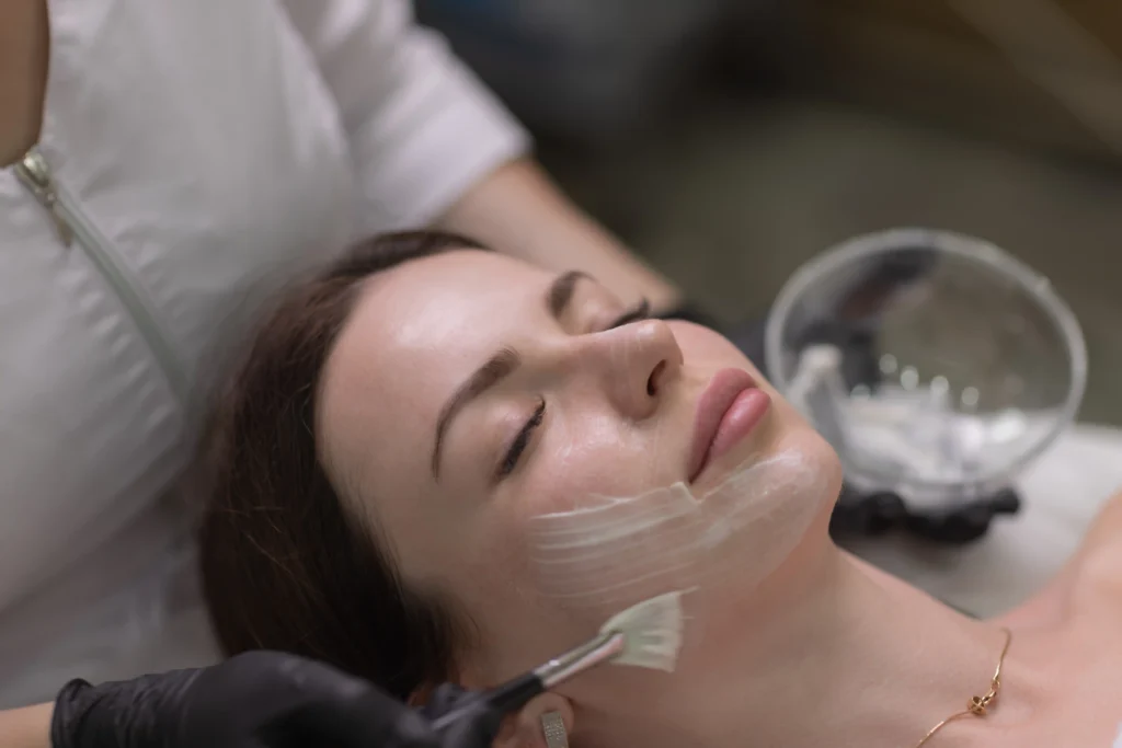 Chemical Peel in Dubai - Roxana Aesthetics Clinic