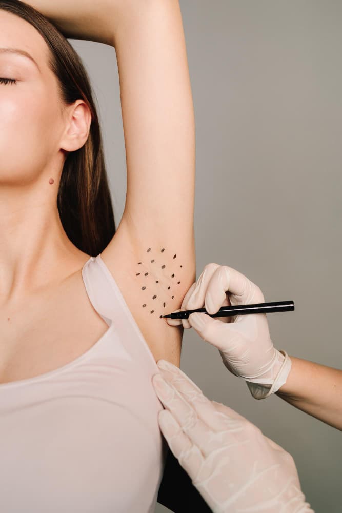 Underarm botox Dubai