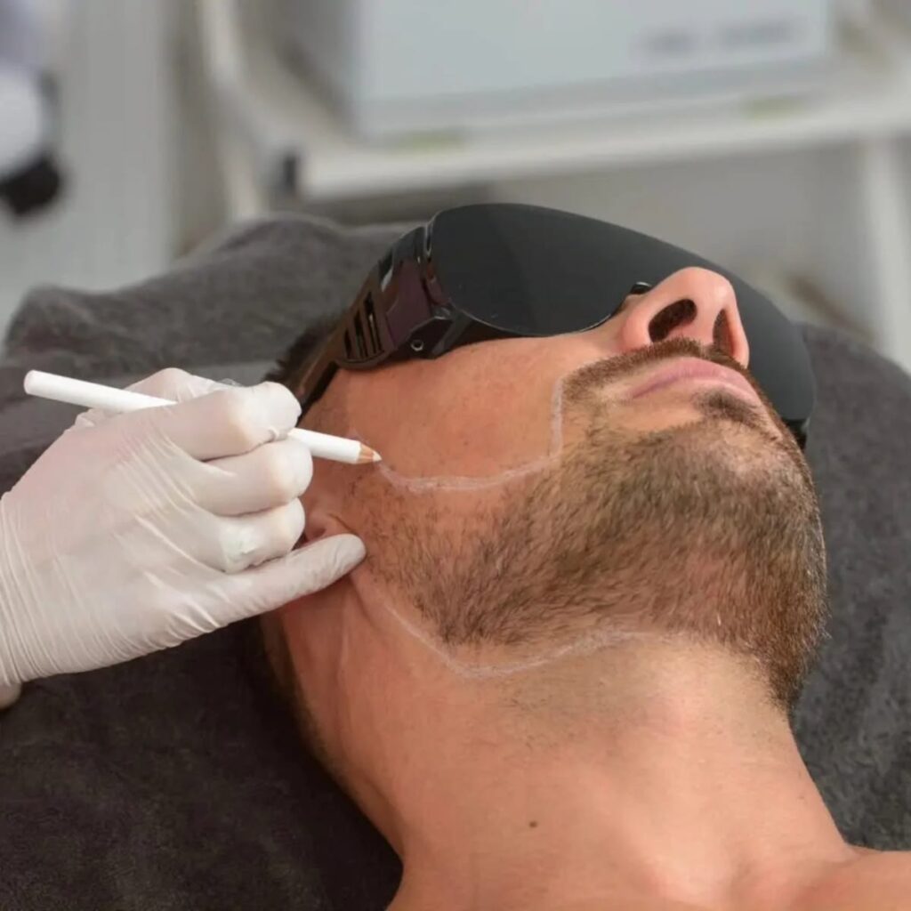Man receiving laser hair removal at Roxana Aesthetics Clinic